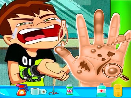 Ben10 Hand Doctor – Free Online Game